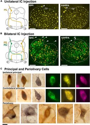 The lateral superior olive in the mouse: Two systems of projecting neurons